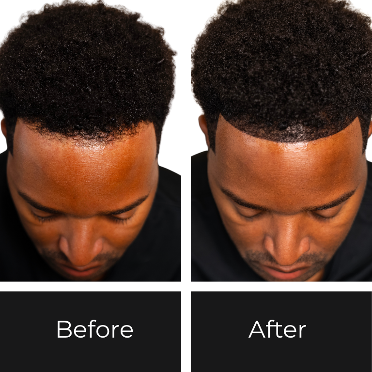 Before_After (768 x 768 px) (2)